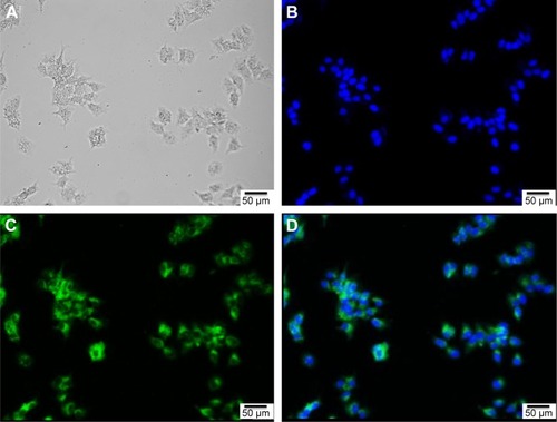 Figure 3 Images of MCF-7 breast cancer cells treated with quercetin-mixed polymeric micelles.Notes: Bright field of cells (A); fluorescence images of cell nuclei stained with Hoechst 33258 exhibiting blue (B) and coumarin 6 exhibiting green (C); (D) is a merged image of (A–C).