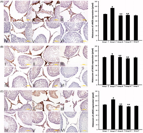 Figure 2. nNOS expression. (A) Immunohistochemical localization of nNOS expression of the testicular tissue and semiquantitative results of nNOS content obtained by densitometric analysis of immunohistochemistry. (B) Immunohistochemical localization of iNOS expression of the testicular tissue and semiquantitative results of iNOS content obtained by densitometric analysis of immunohistochemistry. (C) Immunohistochemical localization of eNOS expression of the testicular tissue and semiquantitative results of eNOS content obtained by densitometric analysis of immunohistochemistry. (I) Group I (control), (II) Group II (STZ-induced diabetic rats), (III) Group III (STZ-induced diabetic rats +50 mg/kg/day PTX through the experiment), (IV) Group IV (STZ-induced diabetic +50 mg/kg/day PTX for just second month), (V) Group V (only 50 mg/kg/day PTX administered to rats), and (NC) Negative controls. nNOS (neuronal nitric oxide synthase), iNOS (inducible nitric oxide synthase), eNOS (endothelial nitric oxide synthase), STZ (streptozotosin) PTX (pentoxifylline). *p < 0.05 compared to Group I, **p < 0.05 compared to Group II.