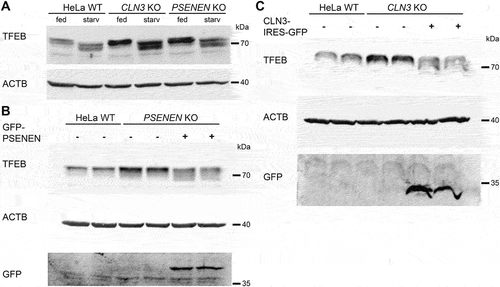Figure 8. Increased TFEB levels in PSENEN KO and CLN3 KO cells. (A) Immunoblot analysis of TFEB in HeLa wild type (WT), CLN3 KO and PSENEN KO cells under control conditions (fed) and after 3 h starvation (starv). ACTB levels are shown as loading controls. (B) Elevated TFEB levels under control conditions in PSENEN KO cells were reduced to wild type levels when stably transfected with GFP-PSENEN. Stable GFP-PSENEN expression was confirmed using anti-GFP antibody. Two independent cell clones were analyzed. (C) Elevated TFEB levels under control conditions in CLN3 KO cells were reduced to wild type levels when stably transfected with CLN3. Stable expression of the CLN3-IRES-GFP construct was confirmed by anti-GFP antibody and by sequencing of RT-PCR-amplified CLN3 transcripts. Two independent cell clones were analyzed.