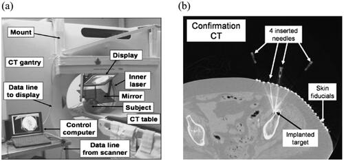 Figure 12. CT image overlay system for flexible steerable needle insertion process. (a) Overall system figure; (b) CT image identified by localization of bone biopsy.