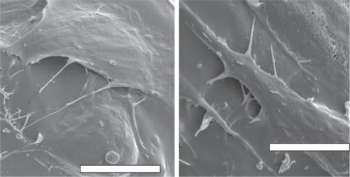 Figure 5 (A) Fibroblast adhesion on unetched PLGA; (B) fibroblast adhesion on etched PLGA. Increased fibroblast spreading was observed on unetched compared to etched PLGA. Bars = 10 μm.