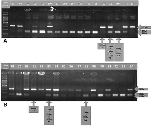Figure 1. Genotyping gel images. Gel images of genotyping analysis of the OX40 (rs17568) gene (A) and the OX40L (rs1234313) gene (B). 100-bp DNA Ladder (New England BioLabs, N3231) was used.