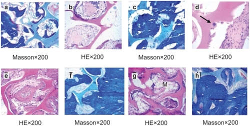 Figure 4 HE staining and Masson’s staining of material implanted in tibiae. a, b–d, e–f, g–h were the histological reaction at 2, 4, 12 and 26 weeks respectively. Arrow points to osteoblast.Abbreviation: M, marrow cavity.