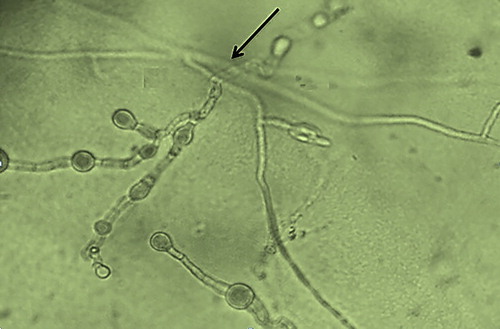 Figure 2. Mycelial interaction between T. harzianum T12 and M. phaseolina.