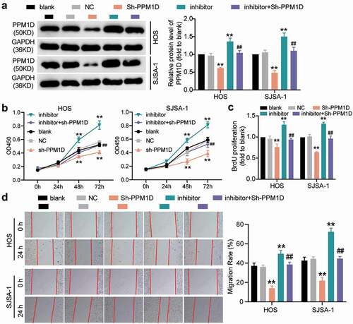 Figure 8. The promoting effect of PPM1D on osteosarcoma cell proliferation and migration is negatively regulated by miR-15b-5p. (a) The relative expression of PPM1D in HOS and SJSA-1 cells transfected with PPM1D shRNA and/or miR-15b-5p inhibitor, as determined via Western blot assay. GAPDH served as a control. The relative level of target proteins was calculated by normalizing their relative density to GAPDH in each group to their corresponding value in the blank group. (b) CCK-8 assay was performed to detect OS cell viability at 0, 24, 48, and 72 h. (c) BrdU assay was used to detect cell proliferation. Statistical data were obtained by normalizing the original OD value in each group to that in the blank group. (d) Wound healing assay was used to detect cell migration. The relative migration rate was measured using the following formula: (W0h−W24 h)/W0 h × 100%, where W represented wound width. (a-d) HOS and SJSA-1 cells were transfected with PPM1D shRNA, miR-15b-5p inhibitor, PPM1D shRNA plus miR-15b-5p inhibitor, or negative control. Blank: blank control; NC: shRNA negative control together with miRNA inhibitor negative control; sh-PPM1D: PPM1D shRNA; inhibitor: miR-15b-5p inhibitor. Data are represented as the mean ± SD. All cellular experiments were performed in triplicates. ** P < 0.001 compared with blank control group. ## P < 0.001 compared with inhibitor group.