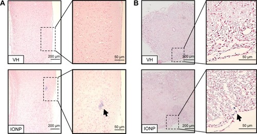 Figure 2 Detection of iron in the CNS of EAE mice.Notes: Tissue sections of the brain and spinal cord obtained from VH- and ferucarbotran-treated EAE mice killed on day 21 were stained with Prussian blue. The regions between (A) the midbrain and the brainstem and (B) the lumbar region of the spinal cord are shown. The right panels are enlarged areas of dashed boxes that show negative and positive staining (blue) for iron in the VH and IONP groups, respectively. Similar results were observed in three individual mice per group.Abbreviations: CNS, central nervous system; EAE, experimental autoimmune encephalomyelitis; IONP, iron oxide nanoparticle; VH, vehicle.