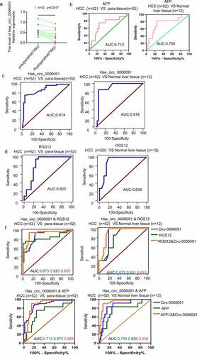 Figure 6. The combination of hsa_circ_0006091 and AFP, hsa_circ_0006091 and RGS12 enhances the diagnostic strategies for HCC. (a) Serum levels of hsa_circ_0006091 were measured in 12 patients 1 day before and 7 days post-surgery. (b-d) ROC curve analysis of AFP, hsa_circ_0006091 and RGS12 differentiated HCC tissues and between paracancer and benign liver tissues, respectively. (f) ROC curve was used for joint diagnosis of hsa_circ_0006091&AFP and hsa_circ_0006091&RGS12, respectively in HCC s (n = 52) versus adjacent tissues (n = 52), HCC versus benign liver disease tissues (n = 12).