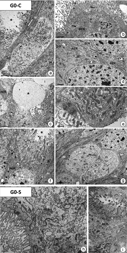 Figure 5. The midgut epithelium of G. mellonella 7th instar larva. (a-g) Control animals (G0-C). TEM. (a) Fragment of the midgut epithelium with digestive cells (dc), goblet cell (gc), and regenerative cell (rc). Mitochondria (m), nuclei (n), goblet cell cavity (star), cytoplasmic projections of the goblet cell (arrows), basal lamina (bl), visceral muscles (vm), autophagic structures (au). Scale bar = 2.9 μm. (b-c) the apical cytoplasm of digestive cells. Microvilli (mv), mitochondria (m), cisterns of RER (RER), nucleus (n), midgut lumen (l), autophagic structures (au), apocrine secretion (star), exocrine secretion (arrows). (b) Scale bar = 1.7 μm. (c) Scale bar = 1.8 μm. (d) Perinuclear cytoplasm in digestive cells. Mitochondria (m), cisterns of RER (RER) and SER (SER), nuclei (n), and glycogen granules (g). Scale bar = 1.4 μm. (e) Basal cytoplasm in the digestive cell with the distinct membranous labyrinth (arrows) surrounded by mitochondria (m), glycogen granules (g), and cisterns of RER (RER). Basal lamina (bl). Scale bar = 0.6 μm. (f) the goblet cell (gc) with the cavity (star) and cytoplasmic projections (arrows) filled with mitochondria (m). Cisterns of RER (RER), autophagic structures (au), nucleus (n), digestive cells (dc). Scale bar = 0.9 μm. (g) a fragment of the regenerative nidi with regenerative cells (rc). Nucleus (n), mitochondria (m), digestive cells (dc). Scale bar = 1.5 μm. (h-i) Fasted animals (G0-S). (h) Fragment of apical regions in digestive cells. Mitochondria (m), cisterns of RER (RER), midgut lumen (l), autophagic structures (au). Scale bar = 0.7 μm. (i) a fragment of goblet cell (gc) with the cavity (star) and cytoplasmic projections (arrows) filled with mitochondria (m). Digestive cell (dc), nucleus (n), cisterns of RER (RER). Scale bar = 1 μm.