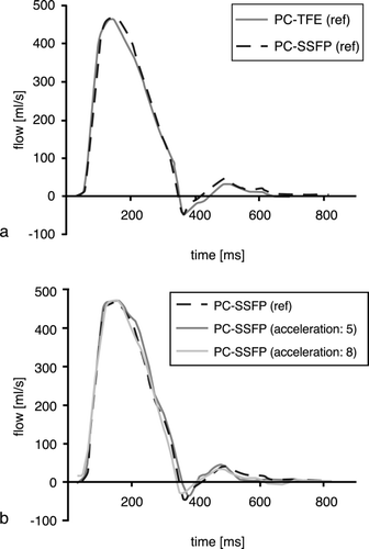 Figure 3. (a) Flow profiles acquired with the reference PC‐SSFP and PC‐TFE sequence. (b) Flow profiles calculated from the reference and the accelerated PC‐SSFP measurements.