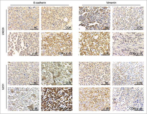 Figure 8. The Immunohistochemistry showed the effect of Curcumin on induction of EMT in vivo. All images was taken microscopically (40 ×). The expression of E-cadherin was upregulated in CCM+γ-IR group and Vimentin was downregulated compared with NC group. Both LN229 and U251 showed the similar results.