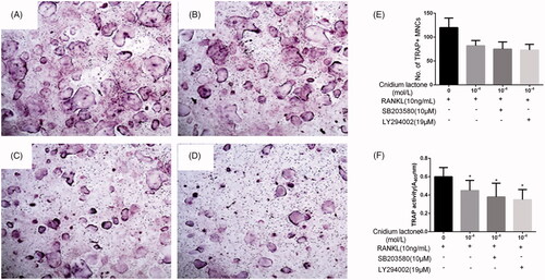 Figure 3. Cnidium lactone and SB203580 or LY294002 inhibited the osteoclast differentiation and TRAP(+) multinuclear mature osteoclast formation. (A) Control group, (B) cnidium lactone group (10−4 mol/L) combined with RANKL (100 ng/mL), (C) cnidium lactone group (10−4 mol/L) combined with RANKL (100 ng/mL) and SB203580, (D) cnidium lactone group (10−4 mol/L) combined with RANKL (100 ng/mL) and LY294002, (E) quantification of no. of TRAP(+) MNCs and (F) TRAP activity (A405 nm). *p < 0.05 compared with control group (0 mol/L cnidium lactone).