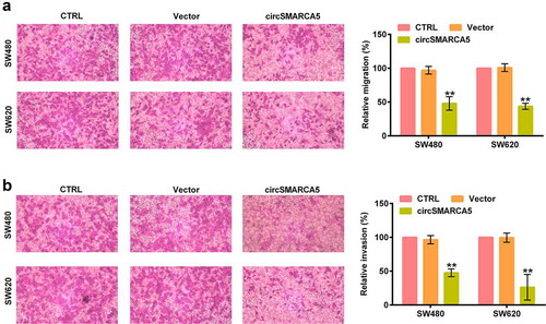 Figure 4. Impacts of circSMARCA5 on colon cancer migration and invasion. SW480 and SW620 cells were transfected with circSMARCA5 overexpressing plasmid. (a) Migration capacity assessed by Transwell assay. (b) Invasion capacity assessed by Matrigel Transwell assay. ** p < 0.01