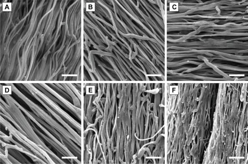 Figure 2 SEM images of PDO electrospun filaments loaded with various amounts of curcumin.Notes: (A) 0%, (B) 0.001%, (C) 0.01%, (D) 0.1%, (E) 1%, (F) 10% (percent weight to weight ratio of PDO). Scale bars represent 20 μm; magnification 3,000×.Abbreviations: PDO, polydioxanone; SEM, scanning electron microscopy.