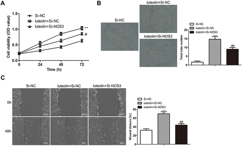 Figure 6 NO mediates the effect of luteolin on proliferation, angiogenesis and migration in HMEC-1 cells. HMEC-1 cells were transfected with Si-NC and Si-NOS3, and then treated with 10 μM luteolin. (A) The cell viability was analyzed by CCK-8 assay. (B) Tube formation experiment was used to observe the lumen structure of HMEC-1 cells. (C) migration was analyzed by scratch assays. Scale bar =200μm. The values were presented as mean ± SD (n=3). **P<0.01 and ***P<0.001 versus the Si-NC group. #P<0.05, ##P<0.01 versus the luteolin + Si-NC group.