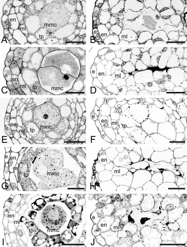 Figure 6 A–J. Bright field micrographs of Consolea millspaughii, C. moniliformis, C. nashii, C. rubescens and C. spinosissima male‐sterile anthers at stage 2 (left column) and at abortion (right column). A–B. C. millspaughii. A. Anther wall composed of epidermis (e), endothecium (en), middle layer (ml), and radially enlarged tapetum (tp); notice the single large vacuole in the tp cells. B. Remaining anther wall layers: e, en and radially enlarged ml; within the anther locule; some mmc and tp cell remmants are visible. C–D. C. moniliformis. C. e, en, ml and radially enlarged tp with single large vacuoles; the mmc's show some signs of degeneration. D. All anther layers except e, invading the locule, and in the center, a dark mass representing all that is left of the mmc's. E–F. C. nashii. E. e, en, ml, and radially enlarged tp with single large vacuoles. F. tp cells enlarged and invading the locule. G–H. C. rubescens. G. e, en, ml and somewhat enlarged tp cells with numerous small vacuoles. H. en and ml layers greatly enlarged and invading the locule; in the center, remnants of mmc's and tp cells are visible as dark masses. I–J. C. spinosissima. I. e, en, ml and somewhat radially enlarged tp with numerous small vacuoles. J. Enlarged en and ml invading the locule, and in the center, remnants of aborted tp cells and mmc's. Scale bars – 25 µm (A–J).