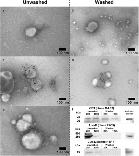 Figure 2. TEM and western blotting was applied to verify the presence of EV subpopulations in both washed and unwashed pellets. TEM showing EV-characteristics, i.e. shape and size in (A) unwashed and (B) washed pellets. Immunogold labelling with anti-CD9 (clone M-L13) bound to EVs in unwashed (C) and washed (D) pellets confirming presence of CD9-positive subpopulations. (E) Small (<50 nm) vesicular structures adhering to or residing in proximity to larger vesicles. (F) Western blot with anti-CD9, anti-CD142 (clone HTF-1), and anti-apolipoprotein B (clone F2C9) on a pellet pool for each pellet type showing the presence of EV marker CD9 and the removal of apolipoprotein B after washing in PBS.