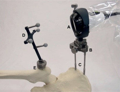 Figure 1 The Intellijoint HIP 3D mini-optical navigation tool.