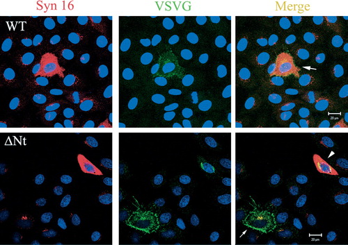 Figure S3.  Effect of Syn 16-ΔNt on anterograde VSVG transport. In cells over-expressing the Syn 16 wild type (WT) protein, anterograde transport of VSVG to the cell surface is not significantly affected (arrow, top panel). In cells over-expressing Syn 16 ΔNt, a significant amount of VSVG remains in the perinuclear region (arrowhead, bottom panel). This Golgi/TGN retardation is not as severe in cells expressing only a low amount of Syn 16-ΔNt (arrow, bottom panel).