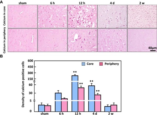 Figure 5 The analysis of Alizarin red-positive cells in the ischemic core and periphery regions of the cortex. (A) Representative images of Alizarin red staining (B) showing the density of calcium-deposited in cells peaked at 12 h in the ischemic core and periphery regions of the brain. Bar scale= 40 µm. **P < 0.01, compared to sham.