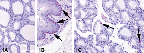 Figure 1.  Proliferating Cell Nuclear Antigen (PCNA) immunostaining of control and F. sellowiana extracts treated rats. Representative figures were stained with avidin−biotin−complex peroxidase method with Mayer’s hematoxylin counterstain. The original magnification was 400x and the scale bars represent 50 µm. (A) Negative control, primary antibody was replaced with phosphate-buffered saline, did not show any staining. (B) Positive control, esophageal basal cells showed PCNA immunopositivity (arrows). (C) Only a few PCNA immunopositivity were seen in the nucleus of tubular epithelium in all groups (arrows).