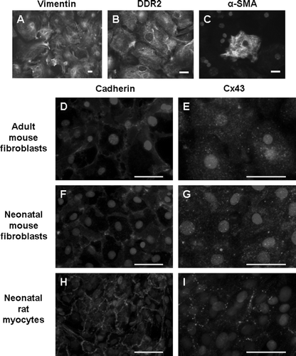 Figure 1.  Adult mouse cardiac fibroblast cultures express vimentin (A) and DDR2 (B). A subset of cells also expresses α-SMA (C). Cx43 signal is punctate and diffuse in both adult (E) and neonatal mouse fibroblasts (G). Neonatal rat myocytes exhibit the typical cardiac Cx43 staining at intercellular junctions (I). Pan-cadherin staining is evident at cell-cell junctions in each cell type (D, F, H). The limited appositional membrane staining in adult cardiac fibroblasts belies the fact that the fibroblast cultures are well coupled. Bar = 50 µm.