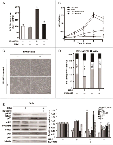 Figure 6. Maintenance of intracellular redox homeostasis by oxidized ATM plays a minor role in CAFs proliferation. (A) CAFs were pretreated with NAC (1 mM) for 2 h before treatment with KU60019 (5 μM) for 24 h. Fluorescent H2DCFDA levels were measured in these cells (*, P < 0.05 in comparing CAFs treated with or without KU60019); (#, P < 0.05 in comparing CAFs in the presence of KU60019 plus NAC-treated or NAC-untreated). (B) Growth curves of CAFs were measured by MTT assay at the indicated time points. The treatment of CAFs with KU60019 (5 μM) and NAC (1 mM) was as indicated. (*, P < 0.05, CAFs treated with KU60019+NAC vs CAFs with KU60019 only); (#, P < 0.05, CAFs treated with or without KU60019). (C) Photomicrographs of CAFs treated with KU60019 (5 μM) for 2 d in the presence or absence of NAC (1 μM). Scale bars, 50 μm. (D) Flow cytometry analyses of CAFs treated with KU60019 (5 μM) for 24 h in the presence or absence of NAC (1 μM). (E) CAFs was treated with KU60019 (5 μM) for 24 h in the presence of NAC (1 mM). Western blotting analyses were done with the indicated antibodies (*, P < 0.05, and #, P < 0.05 is similar with (B) indicated).