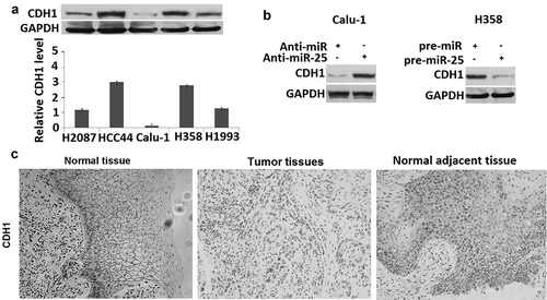 Figure 3. miR-25 regulates the expression of CDH1. (a) The cell lysates of H2087, HCC44, Calu-1, H358, and H1993 cells were prepared for Western blotting using antibody against CDH1; GAPDH was used as a loading control. (b) Calu-1 cells were transfected with 30 nM anti-miR and anti-miR-25, cells were collected for Western blotting using antibody against human CDH1 and GAPDH was used as a loading control. H358 cells were transfected with 30 nM pre-miR and pre-miR-25, cells were collected for Western blotting using antibody against human CDH1 and GAPDH was used as a loading control. (c) expression of CDH1 in normal tissues, tumor tissues, and tumor-adjacent tissues was examined by IHC.