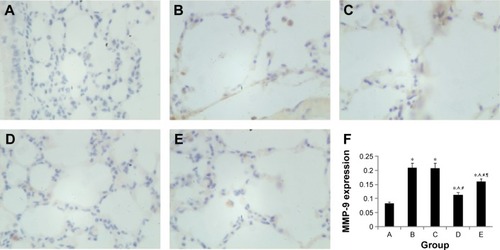 Figure 8 MMP-9 protein expression in immunohistochemical staining.