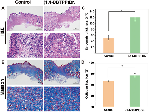 Figure 8 (A) Hematoxylin-eosin (H&E) staining and (B) Masson’s trichrome (MT) staining images of infected wound tissue after various treatments for 12 d. (C) Thickness of newly formed epidermis (n = 3). (D) Collagen deposition on day 12 (n = 3), *p < 0.05.