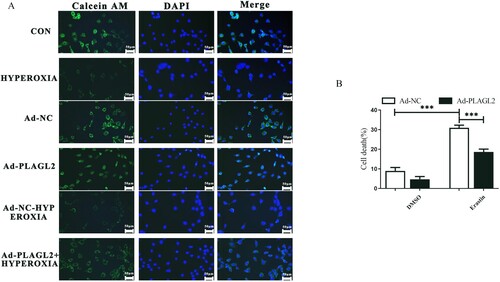 Figure 6. PLAGL2 inhibits ferroptosis in AECII cells. (A) AECII cells were stained using the Calcein AM staining kit. (B) Ad-NC and Ad-PLAGL2 AECII cells were treated with DMSO and erastin for 8 hours. Cell viability was examined through Trypan blue staining. *p < 0. 05, **p < 0. 01, ***p < 0. 001 was considered statistically significant.