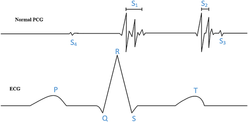 Figure 3 ECG signal and PCG relationship diagram.