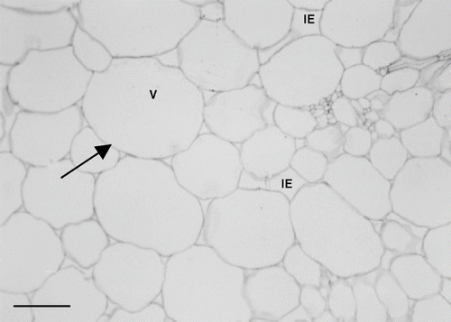 Figure 6 Micrograph of fresh melon mesocarp (parenchyma tissue). Scale bar = 140μm. V = vacuole; IE = intercellular spaces; solid arrow = cell wall.
