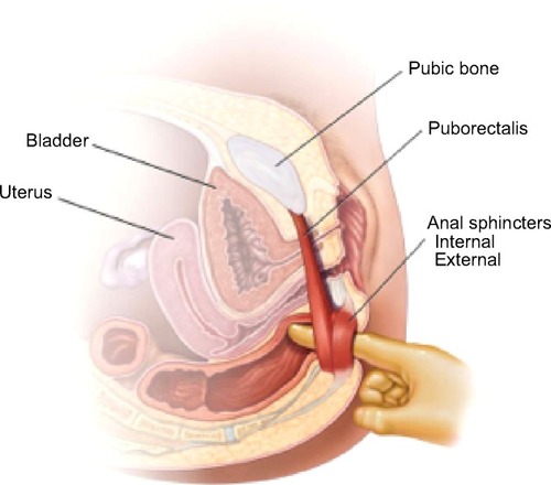 Figure 3 Anorectal examination.