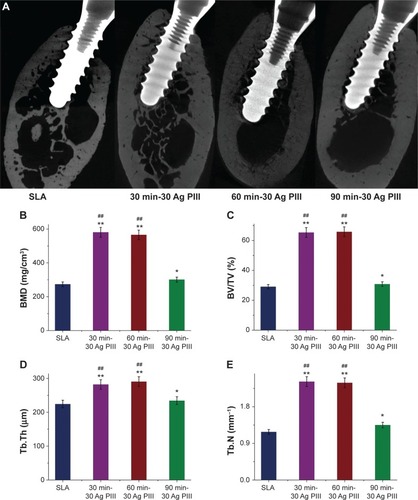 Figure 5 Radiography and micro-CT evaluation of the bone tissue around dental implants at 12 weeks after implantation.Notes: Control group (SLA), 30 min-30 Ag PIII treated group, 60 min-30 Ag PIII treated group, 90 min-30 Ag PIII treated group (A–E from left to right). Representative photographs showed obviously more mineralized tissue formed in the Ag PIII groups than the control (A). The BMD, BV/TV, Tb.Th, Tb.N of the bone volume adjacent to the implant surface were quantified (B–E respectively); *P<0.01 versus the control SLA group; **P<0.05 versus the control SLA group; ##P<0.01 versus the 90 min-30 Ag PIII group.Abbreviations: Ag-PIII, silver plasma immersion ion implantation; BMD, bone mineral density; BV/TV, bone volume/total volume; CT, computed tomography; SLA, titanium surfaces treated by sandblasting with large grit and acid etching procedure; Tb.N, trabecular number; Tb.Th, trabecular thickness; 30 min-30 Ag PIII, titanium surfaces treated by first SLA procedure and then silver plasma immersion ion implantation at 30 kV for 30 minutes; 60 min-30 Ag PIII, titanium surfaces treated by first SLA procedure and then silver plasma immersion ion implantation at 30 kV for 60 minutes; 90 min-30 Ag PIII, titanium surfaces treated by first SLA procedure and then silver plasma immersion ion implantation at 30 kV for 90 minutes.