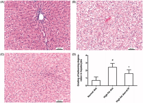 Figure 2. Histological findings in rabbit liver. (A) Representative histological photograph from a normal diet-fed rabbit. (B) Severe ballooning degeneration in hepatocyte in high-fat diet fed rabbit. (C) Mild ballooning degeneration in hepatocyte in a ATP supplementation rabbit. (D) ATP supplementation resulted in a significant reduction in grading of ballooning degeneration in hepatocytes. #p < 0.05 versus normal diet; *p < 0.05 versus high-fat diet. N = 8.