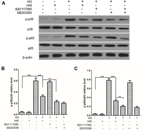 Figure 9 Expression of key proteins on p38/NF-kB pathway in podocytes. (A, B) Representative protein bands of p38, p-p38, p65, and p-p65 (A), and statistical comparison of gray values (B, C). When comparing between two groups, **indicates P < 0.01 and ***indicates P < 0.001.