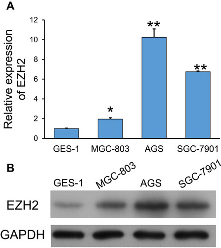 Figure 1 Expression of EZH2 in GC cell lines. (A, B) Quantitative PCR (A) and Western blotting (B) were used to examine EZH2 expression in GC cell lines (MGC-803, AGS, and SGC-7901) and the gastric epithelial cell line, GES-1. GAPDH served as an internal control. *p < 0.05, **p < 0.01, as compared with GES-1 cells.