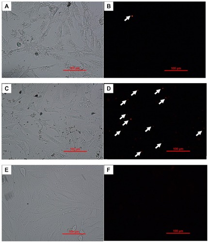 Figure 3 Cellular uptake of TR-BSA or TR-BSA-loaded particles after 4 hours incubation with medium, by mouse embryonic fibroblast cells.Notes: (A and B) TR-BSA-loaded PLGA nanoparticles; (C and D): TR-BSA-loaded PLNs; (E and F): TR-BSA. (A, C, E) Bright field; (B, D, F) fluorescent red signal. The arrows refer to the fluorescent staining of TR-BSA in the nanoparticles.Abbreviations: TR-BSA, Texas Red-labeled bovine serum albumin; PLGA, poly(lactic-co-glycolic) acid; PLN, polymer–lipid nanoparticle.