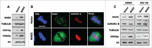 Figure 3. MAD2 overexpression enhances AURORA B-mediated phosphorylation of histone H3 during mitosis. (A). HeLa cells were transfected with an empty vector or MAD2 overexpression plasmid for 48 hours, followed by immunoblotting with anti-MAD2 and phosphorylation specific antibodies against histone H3 residues serine 10 and serine 28. Western blotting with histone H3 and TUBULIN antibodies were performed as controls. (B). HeLa cells were transfected with vector or MAD2 overexpression plasmid for 48 hours, followed by immunofluorescence analysis with anti-MAD2 and anti-AURORA B antibodies to visualize the mitotic localization of AURORA B during metaphase. DNA was stained with Hoechst. Scale bar is 10 microns. (C). HeLa cells were transfected with vector or MAD2 overexpression plasmid for 48 hours followed by treatment with either DMSO or MG-132 (5 µM) for 4 hours. Immunoblotting was performed in with anti-MAD2 and anti-AURORA antibodies. The phosphorylation status of histone H3 at serine 28 was probed using its phospho-site specific antibody. Western blotting with histone H3 and TUBULIN antibodies were performed as controls.