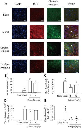 Figure 3 Catalpol promoted survival newborn neurons via downregulating Cleaved-caspase-3. (A) The effects of catalpol on the survival of newborn neurons were indicated by double-staining for Tuj-1(cy3, red), a marker of newborn neurons. and for cleaved caspase 3 (alexa-488, green), a marker of cell apoptosis (200×, bar = 100 μm). Co-labeling of apoptosis (green) and Tuj-1 (red) showed apoptotic newborn neurons in the peri-infarcted area at 7 days after pMCAO. Co-localization of Tuj-1 and cleaved caspase 3 is shown in yellow. Statistical analyses are shown for the number of Tuj-1 (B), cleaved caspase 3 (C), co-Tuj-1 and cleaved caspase 3 (D), and the ratio of cells co-stained with cleaved caspase 3 and Tuj-1 among Tuj-1-positive cells (E). *p < 0.05 vs. sham, #p < 0.05 vs. model.