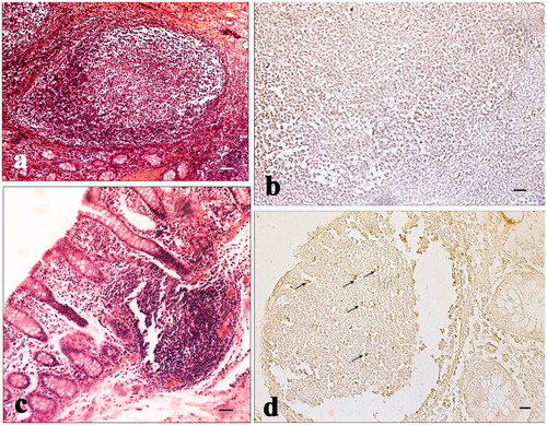 Figure 6. Immunohistochemical analysis of cyclooxygenase-2 (COX-2) in the ileum and Peyer’s patches: (a) hematoxylin–eosin staining of the ileum solitary follicle of a pig of the experimental group; (b) absence of immunopositivities staining in the same ileum follicle solitary showed in the previous picture (histological section consecutive to the previous one); (c) hematoxylin–eosin staining of a Peyer’s patch of the caecum of a control pig; and (d) various immunopositive cells (arrows) located in the same Peyer’s patch showed in the previous picture (histological section consecutive to the previous one). Scale bars: 20 µm (a and d); 10 µm (b); and 50 µm (c).