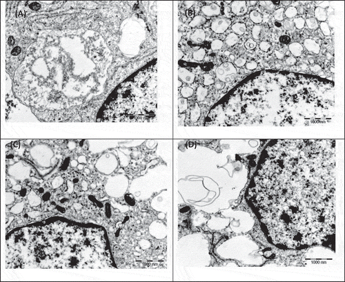 Figure 4. TEM electron micrograph of RAW 264.7 macrophage control cells upon exposure to (A) 1 ppm tryptamine shows early necrosis with nucleus disintegration, vacuolization and intact mitochondria; (B) 1 ppm spermine shows late necrosis with nucleus disintegration and mitochondria disintegration; (C) 100 ppm spermine shows early necrosis with nucleus disintegration, vacuolization and intact mitochondria and (D) 1 ppm spermidine shows late necrosis with nucleus disintegration and there are still some intact mitochondria.