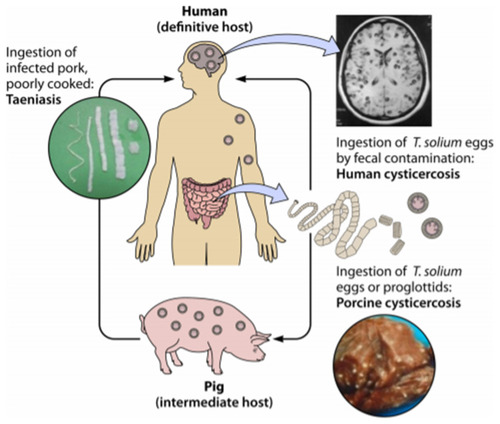 Figure 2 Life cycle of T. solium Development of both taeniasis and cysticercosis.