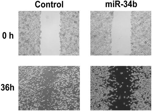 Figure 5. Effect of miR-34b on the migration of C33a cell line.
