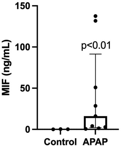 Figure 1. MIF is elevated in serum from an overdose population. MIF serum concentrations were compared between an overdose cohort (acetaminophen overdose) and negative controls (no acetaminophen overdose or liver injury). Results are displayed as box plots representing median/IQR, with individual patient values represented for each group; p = 0.0091 using a Mann-Whitney U test.