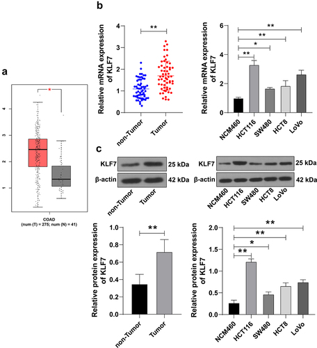 Figure 1. KLF7 was highly expressed in CRC. (a) GEPIA2 database online prediction showed that KLF7 was highly expressed in COAD. (b-c) KLF7 expression in cancer tissues, adjacent tissues (n = 57), and different cell lines was detected using qRT PCR and Western blot. The cell experiment was repeated 3 times independently. Data in panels B (left) and C (left) were analyzed using t test, and data in panels B (right) and C (right) were analyzed using one-way ANOVA, following Tukey’s multiple comparisons test, *p < .05, **p < .01.