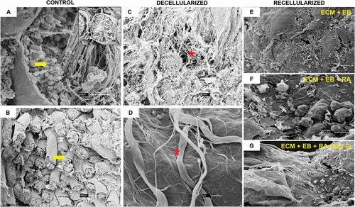 Figure 4. Rat testis SEM. (A, B) The seminiferous tubules and their cells can be seen in the testis of a control rat (yellow arrow). (C, D) It is possible to view the decellularized testis ECM architecture, without cells, and preserved structural proteins, such as collagens fibers (red star). (A, C, G) 30 µm; (B) 300 µm; (D) 1 µm; (E, F) 10 µm.