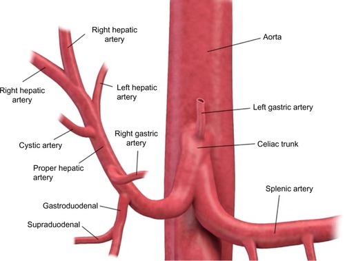Figure 2 Diagram of the arterial anatomy to the liver.