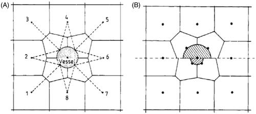 Figure 1. (A) A blood vessel embedded in a tissue voxel with surrounding tissue voxels 1–8. The tissue voxel around the vessel has been divided into four boundary elements. The dotted lines indicate the lines along which the conductive heat flow in the tissue is calculated in the model. (B) shows the geometry around a vessel for two different vessel radii [Citation37]. This picture has been reproduced from Lagendijk JJ et al. (A three-dimensional description of heating patterns in vascularised tissues during hyperthermic treatment. Phys Med Biol 1984;29:495–507. http://dx.doi.org/10.1088/0031-9155/29/5/002). © Institute of Physics and Engineering in Medicine. Published on behalf of IPEM by IOP Publishing Ltd. Reproduced by permission of IOP Publishing. All rights reserved.