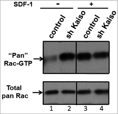 Figure 4. Knockdown of Kaiso is associated with constitutive activation of Rac. GTP-bound (active) Rac is increased at baseline and fails to respond to SDF-1 stimulation after knockdown of Kaiso in Jurkat cells. Rac activity was assessed by PBD pull-down assays and compared to total Rac protein in lysates from Jurkat cells transduced with control or Kaiso shRNA lentivirus and stimulated with SDF-1 (200 ng/ml) for 2 minutes. A representative immunoblot of 3 independent experiments is shown.